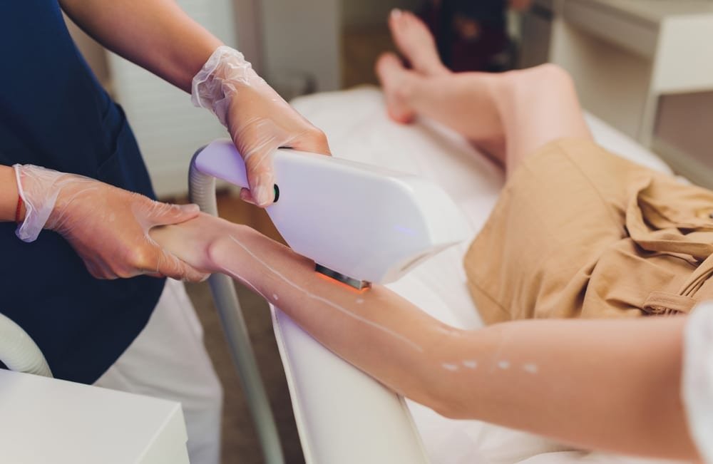 How Long Does Laser Hair Removal Last?